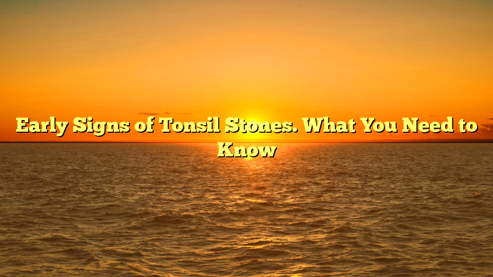 Early Signs of Tonsil Stones. What You Need to Know