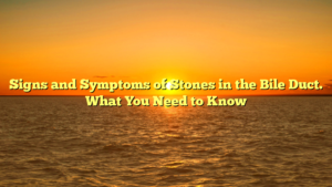 Signs and Symptoms of Stones in the Bile Duct. What You Need to Know